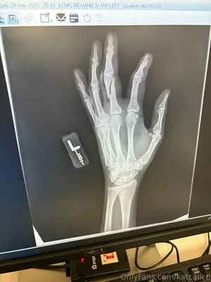 Katcalico OnlyFans Leaked Free Thumbnail Picture - #oxkXNsyXmA