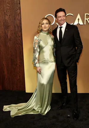 Kate Hudson OnlyFans Leaked Free Thumbnail Picture - #ZptFYX2EGR