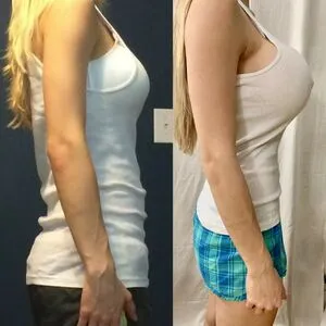 Katelyn Keplar OnlyFans Leaked Free Thumbnail Picture - #jlEYKJImoj