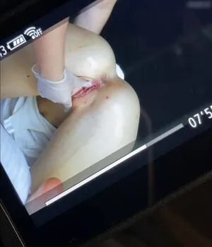 Katharina Eckert OnlyFans Leaked Free Thumbnail Picture - #rIeHx0G9H9