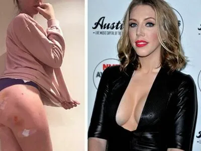 Katherine Ryan OnlyFans Leaked Free Thumbnail Picture - #QpfcnUz14x