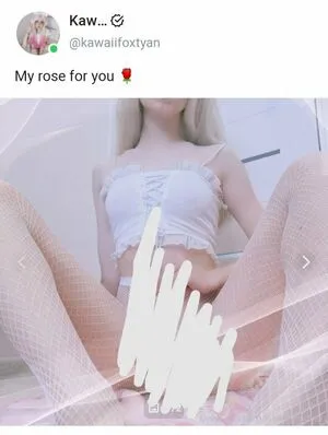 Kawaii Fox Tyan OnlyFans Leaked Free Thumbnail Picture - #Hpqzb2m01m
