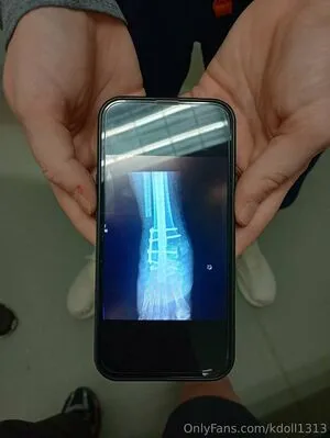 Kdoll1313 OnlyFans Leaked Free Thumbnail Picture - #ZR1WUHHvs2