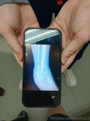 Kdoll1313 OnlyFans Leaked Free Thumbnail Picture - #edFMveriOI