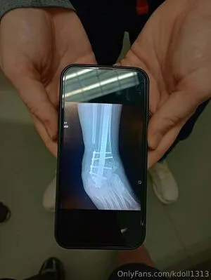 Kdoll1313 OnlyFans Leaked Free Thumbnail Picture - #j19eCy5nlR