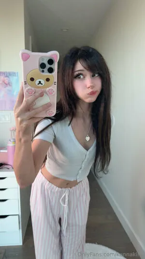 Kennakins OnlyFans Leaked Free Thumbnail Picture - #pSkKoxgfUw