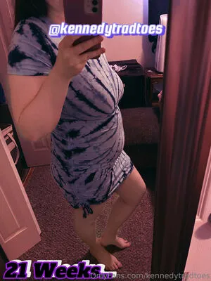 Kennedytradtoes OnlyFans Leaked Free Thumbnail Picture - #iKTsMb5DTj