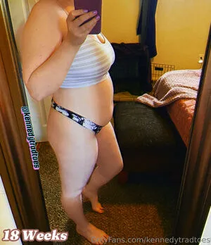 Kennedytradtoes OnlyFans Leaked Free Thumbnail Picture - #m2xua4arsd