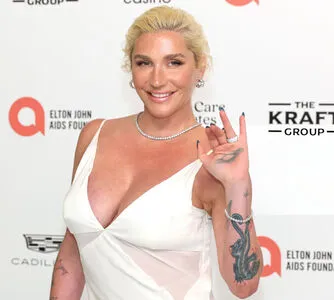 Kesha OnlyFans Leaked Free Thumbnail Picture - #rX1twcNsmU