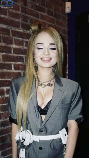 Kim Petras OnlyFans Leaked Free Thumbnail Picture - #Zpr0Y6NR9y