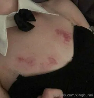 Kingbunni OnlyFans Leaked Free Thumbnail Picture - #qqaACfi6hD