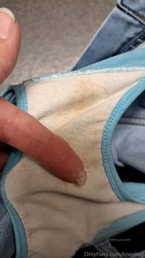 Kneebes OnlyFans Leaked Free Thumbnail Picture - #qp3TICyMBB