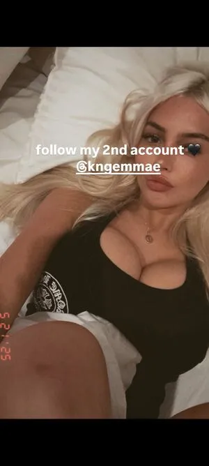 Kngemma OnlyFans Leaked Free Thumbnail Picture - #DOykBzFUNZ