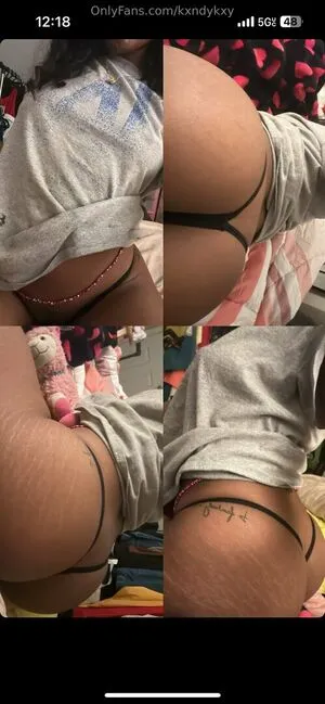Kxndykxy OnlyFans Leaked Free Thumbnail Picture - #nk0aj2t5e8