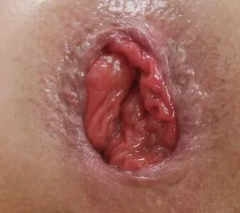 Kyla Scanlon OnlyFans Leaked Free Thumbnail Picture - #FuHIS1xXfU