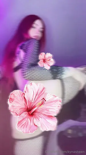 Kynasheen OnlyFans Leaked Free Thumbnail Picture - #KbAqERNKQH