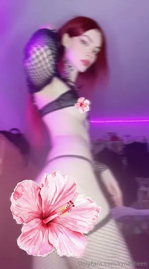 Kynasheen OnlyFans Leaked Free Thumbnail Picture - #fPy8owlkeA