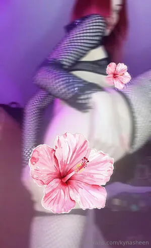 Kynasheen OnlyFans Leaked Free Thumbnail Picture - #oCs7VM19uZ