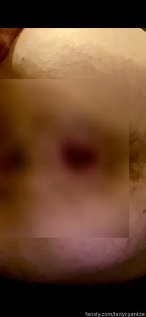 Ladycyanide OnlyFans Leaked Free Thumbnail Picture - #KiW3CrQve8