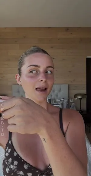 Lea Breuer OnlyFans Leaked Free Thumbnail Picture - #ms8BETw6k0