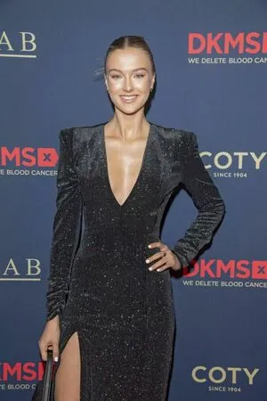 Lilly Krug OnlyFans Leaked Free Thumbnail Picture - #ulIVtqGOlJ