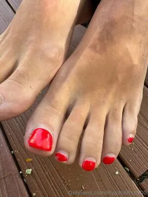 Lily Allen OnlyFans Leaked Free Thumbnail Picture - #vwqqg0wOkl