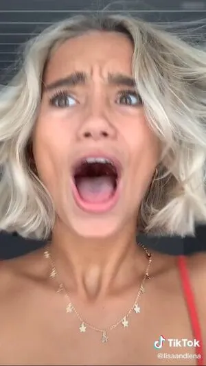 Lisa Und Lena OnlyFans Leaked Free Thumbnail Picture - #OmeKpeddHe