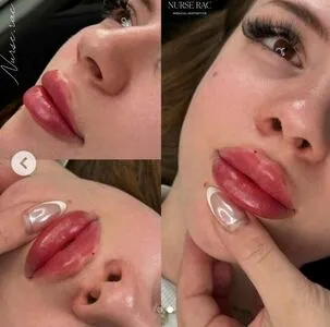 Little Xc OnlyFans Leaked Free Thumbnail Picture - #MyMPOwxx0W