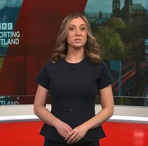 Local Tv Presenters OnlyFans Leaked Free Thumbnail Picture - #gQfBJZePXS