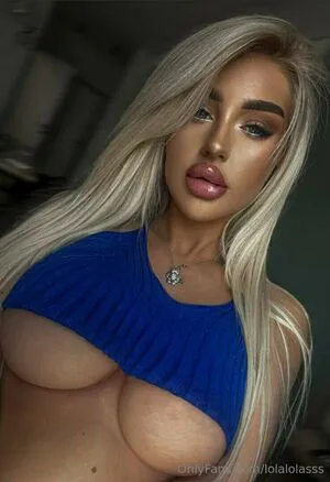 Lolalolasss OnlyFans Leaked Free Thumbnail Picture - #9XP3ioeRaa