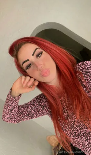 Lolandzac OnlyFans Leaked Free Thumbnail Picture - #vgTUByEz0q