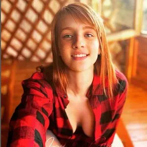Lollipop Ginger OnlyFans Leaked Free Thumbnail Picture - #N7ggynGkwE