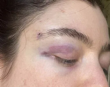 Lorde OnlyFans Leaked Free Thumbnail Picture - #DduEU194fQ