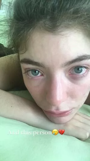 Lorde OnlyFans Leaked Free Thumbnail Picture - #mPSe5pc1bK