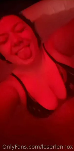 Loserlennox OnlyFans Leaked Free Thumbnail Picture - #CMExxwkqQm