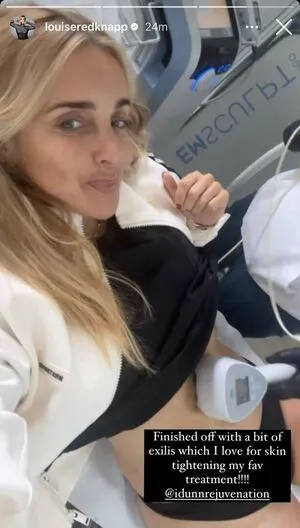 Louise Redknapp OnlyFans Leaked Free Thumbnail Picture - #nXuROK5P4B