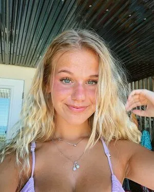 Lydia Feiler OnlyFans Leaked Free Thumbnail Picture - #ZyXk423BCr