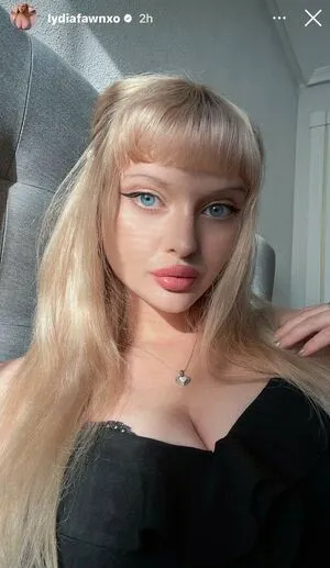 Lydiafawn OnlyFans Leaked Free Thumbnail Picture - #xfkRGr9AAT