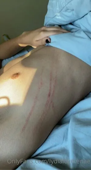 lydialoverenae OnlyFans Leaked Free Thumbnail Picture - #BKc1YBnvNF
