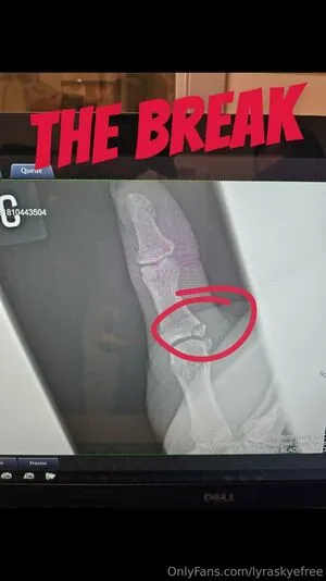 Lyraskyefree OnlyFans Leaked Free Thumbnail Picture - #iGvu4YP6kq