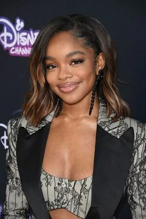 Marsai Martin OnlyFans Leaked Free Thumbnail Picture - #FwP21VcIZS