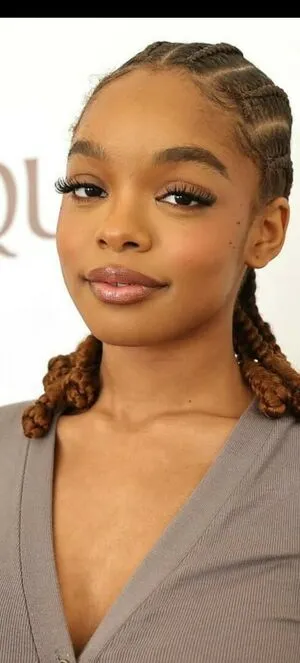 Marsai Martin OnlyFans Leaked Free Thumbnail Picture - #NEatXR5Zks