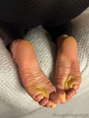 Meadowbarefoot OnlyFans Leaked Free Thumbnail Picture - #nBVOJEpelX