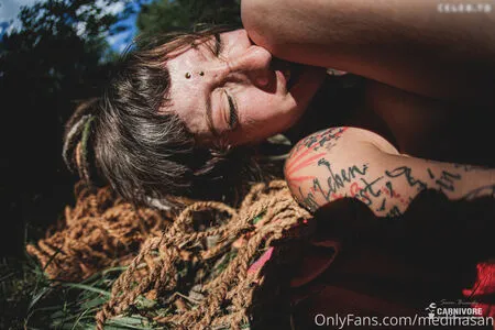 Mediha San Aka Intensivstati0nprinzessin OnlyFans Leaked Free Thumbnail Picture - #TbiTPIcyzK
