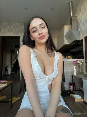 Medixkate OnlyFans Leaked Free Thumbnail Picture - #ZOBo9UGMES
