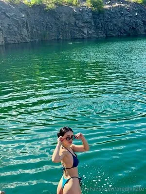 Medixkate OnlyFans Leaked Free Thumbnail Picture - #wCYtpX9Jt0