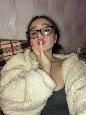 Medixkate OnlyFans Leaked Free Thumbnail Picture - #ALla7yzhOW