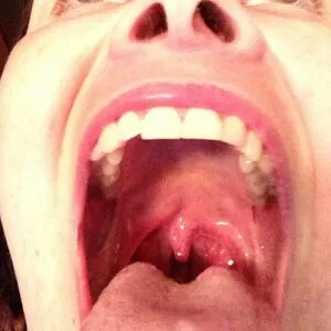 Megan Zass OnlyFans Leaked Free Thumbnail Picture - #IDDxy18IFK