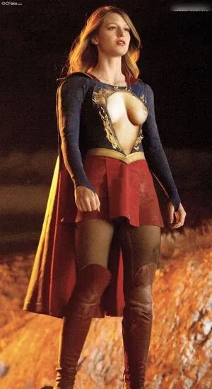 Melissa Benoist OnlyFans Leaked Free Thumbnail Picture - #7zOBJLkbwF