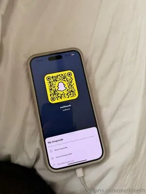 Melkteeth OnlyFans Leaked Free Thumbnail Picture - #Bc5P8x5Qex